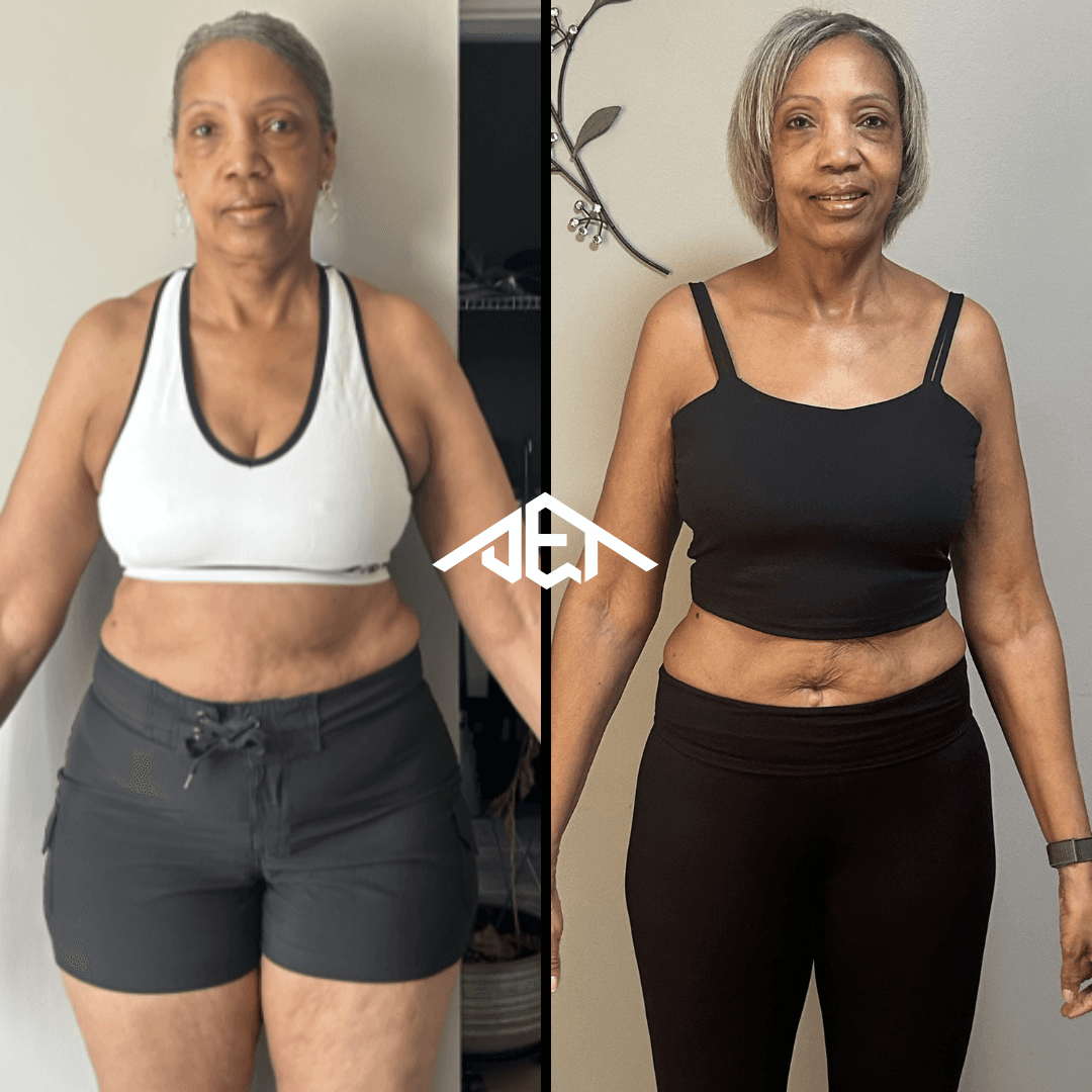 JET Body client before-and-after transformation